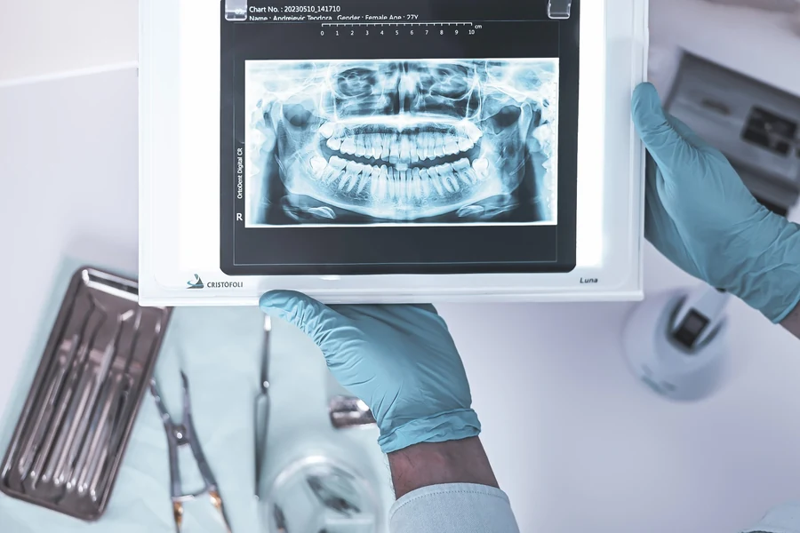 Dentalni snimak i dijagnostika